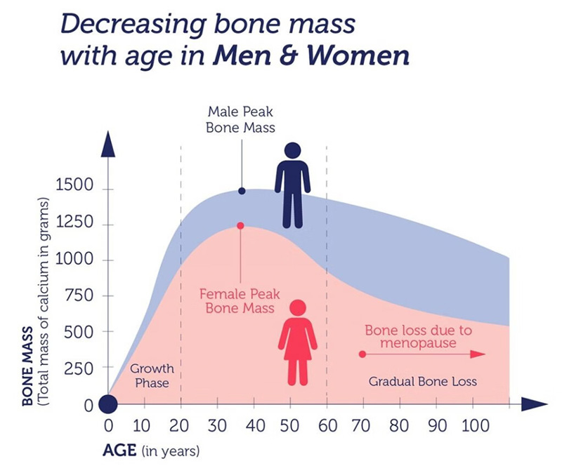 Decreasing bone masswith age in Men 8 Women